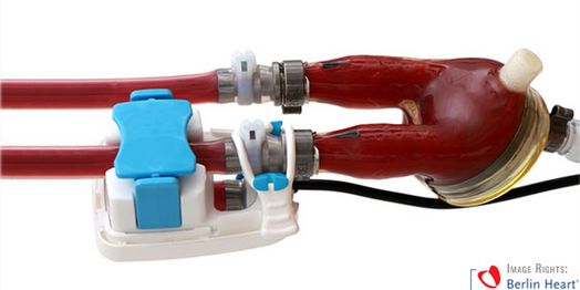 Innovative Flow Sensor for Heart Support System